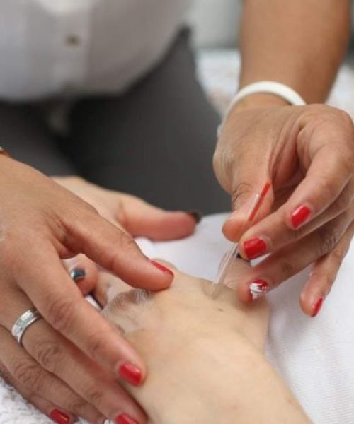 brentwood-acupuncture