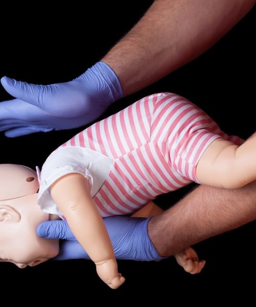 Doctor showing first aid for choking infant